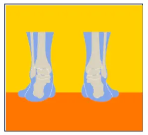 Orthopädie